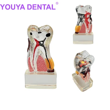 שיניים אנטומי דגם שקוף שן בודדת פירוק מודל רפואת שיניים שן טוחנת מחלת חניכיים הפגנה גם