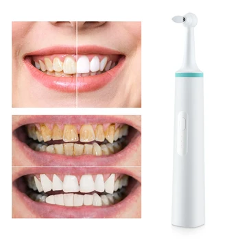 1PC תכליתי השיניים החשמלית לטש אוראלי הכתם מסיר פלאק הלבנת שיניים ניקוי כלי להסיר את השן לניקוי טיפול אוראלי