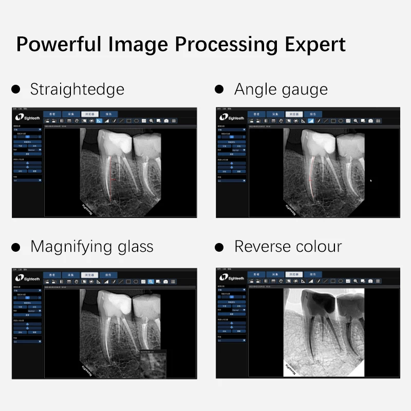 Eighteeth NanoPix שיניים דיגיטלית חיישן נייד תמונת המכונה מערכת וטרינרית חיישנים, מערכות יחידות רנטגן כלים . ' - ' . 5