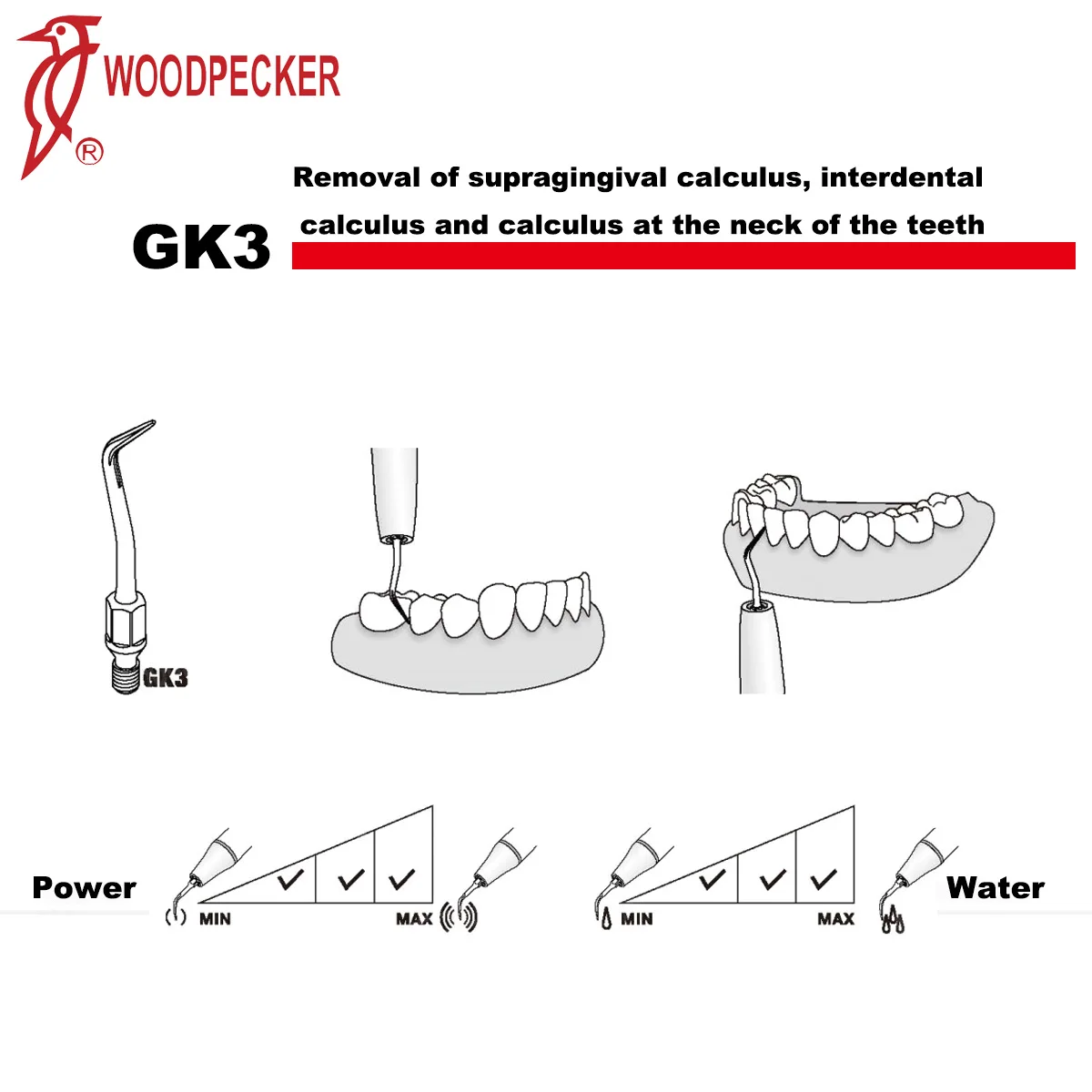 נקר שיניים קולי Piezo Scaler טיפים קנה מידה טיפים GK-סדרת מתאים KAVO קנה מידה ידני שיניים כלים Mergulhos Scalin . ' - ' . 3